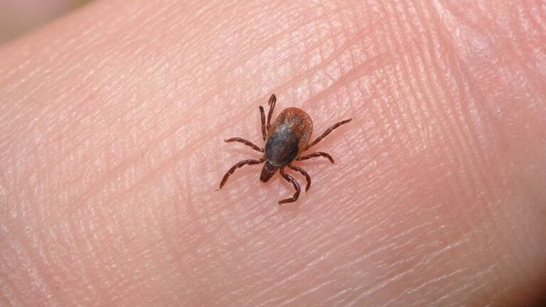 natural lice removal
