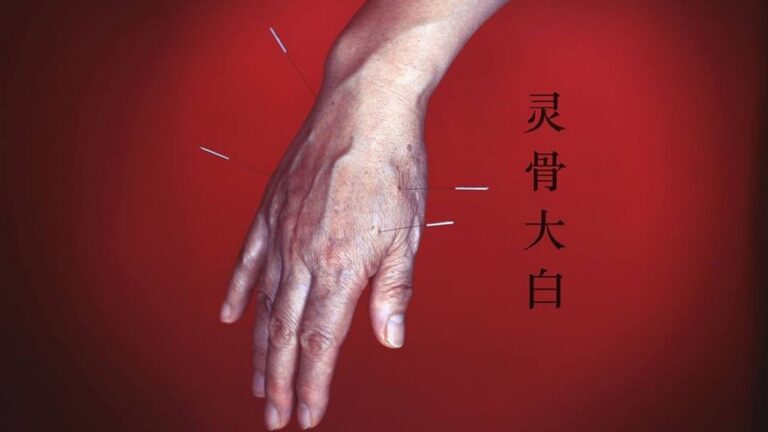 acupuncture meridian points