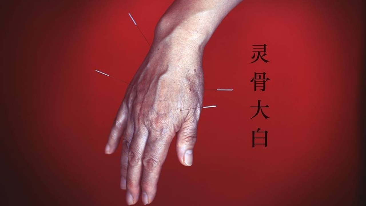 acupuncture meridian points